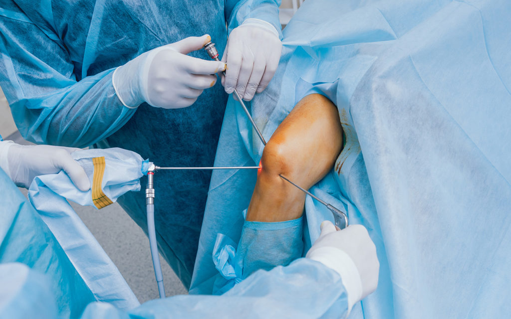 артроскопія колінного суглобу операція